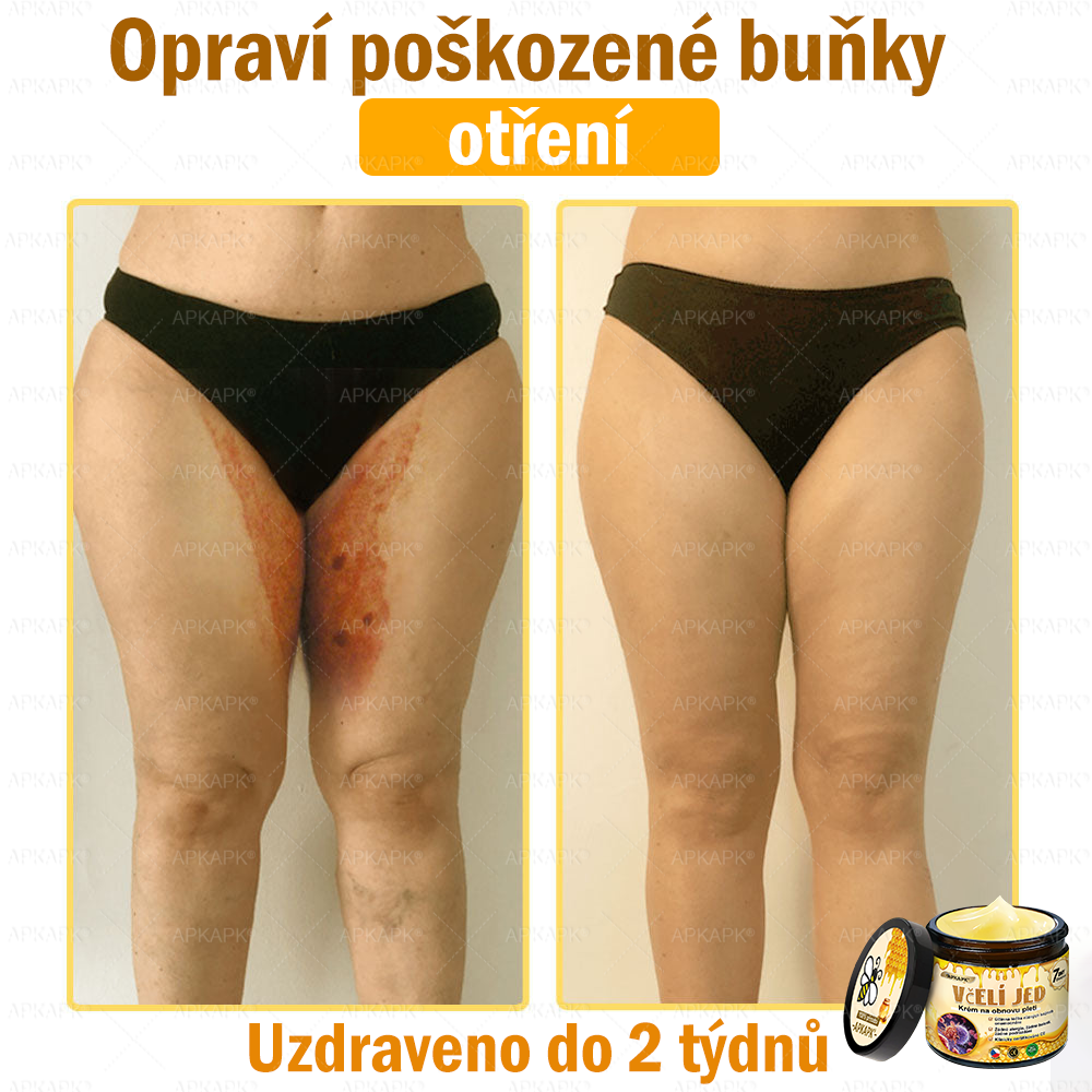 Dermatologicky a klinicky testováno👩‍⚕️APKAPK®Bee Venom Krém na obnovení pleti🐝 pomáhá při léčbě kožních problémů, jako jsou: vrásky, jizvy, pigmentové skvrny, strie, akné, psoriáza, ekzém, kožní změny, podráždění, záněty a další kožní problémy.