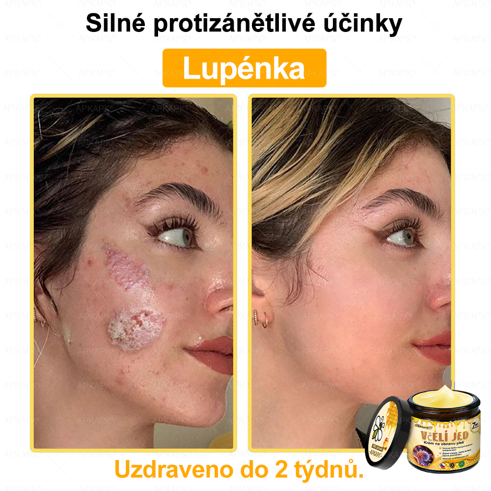 Dermatologicky a klinicky testováno👩‍⚕️APKAPK®Bee Venom Krém na obnovení pleti🐝 pomáhá při léčbě kožních problémů, jako jsou: vrásky, jizvy, pigmentové skvrny, strie, akné, psoriáza, ekzém, kožní změny, podráždění, záněty a další kožní problémy.