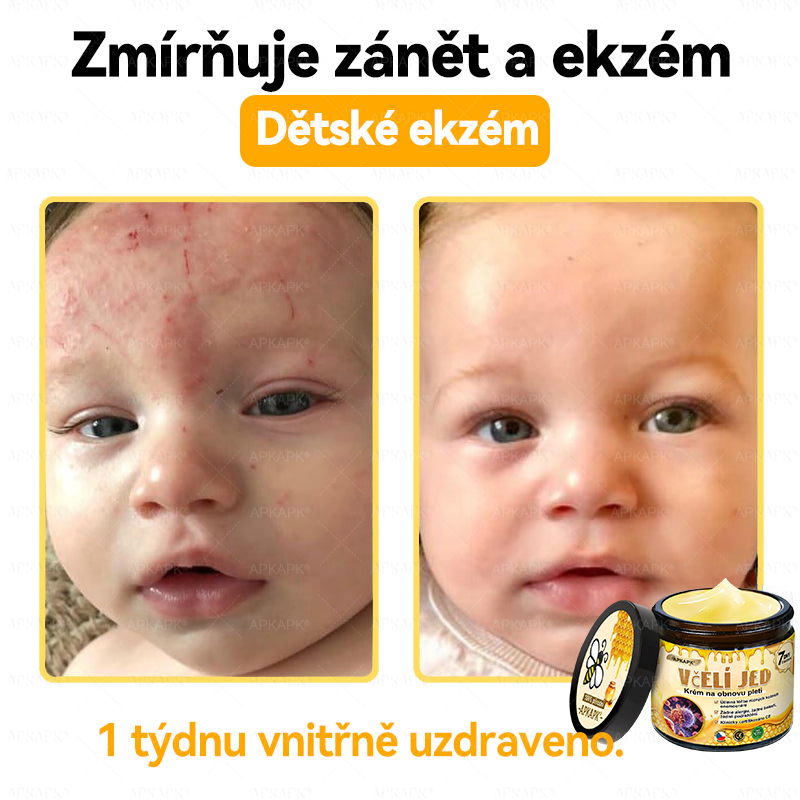 Dermatologicky a klinicky testováno👩‍⚕️APKAPK®Bee Venom Krém na obnovení pleti🐝 pomáhá při léčbě kožních problémů, jako jsou: vrásky, jizvy, pigmentové skvrny, strie, akné, psoriáza, ekzém, kožní změny, podráždění, záněty a další kožní problémy.